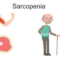 Sarcopenia: perdere forza con l'età non è inevitabile